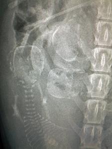 röntgen 3-1